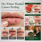 🎄Christmas Moisturizing Lip Balm Set